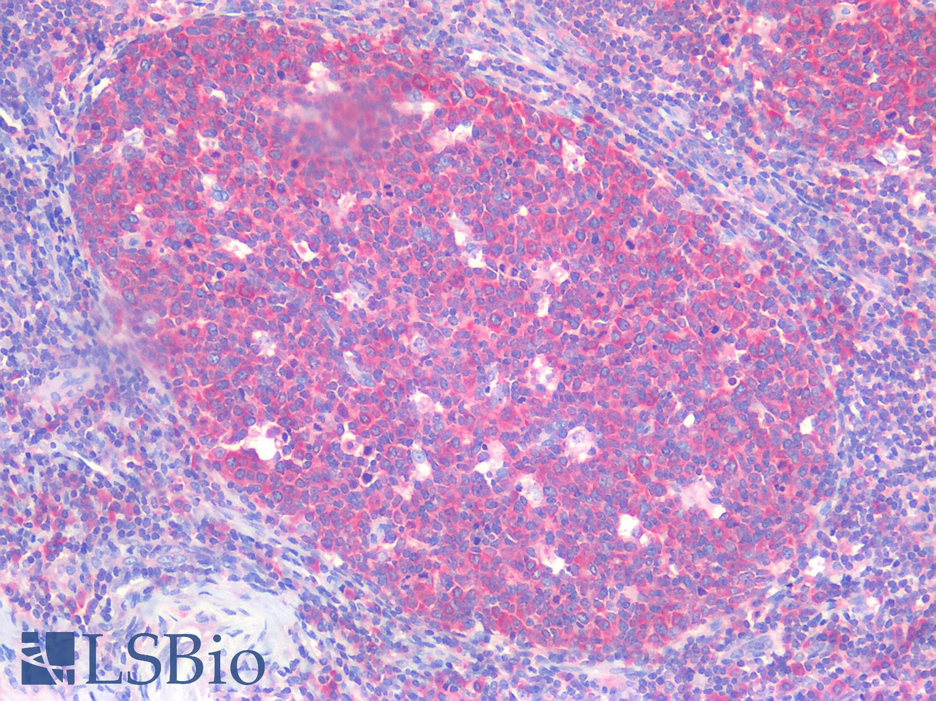 IHC-plus™ Polyclonal Rabbit anti-Human GARS / Glycyl tRNA Synthetase Antibody (IHC, IF, WB)