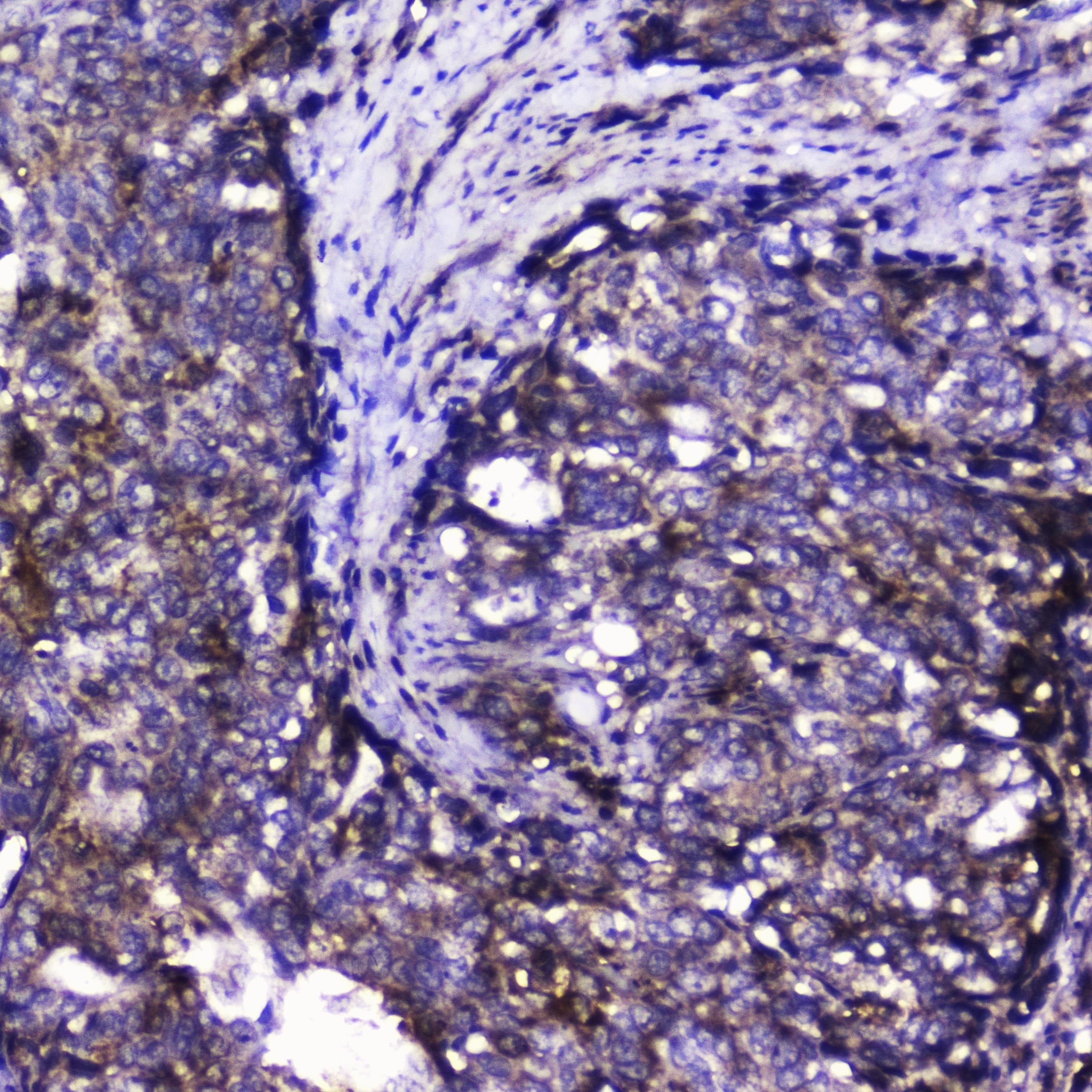 CDK6 Antibody