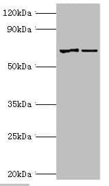 Polyclonal Rabbit anti-Human MTM1 / Myotubularin Antibody (aa484-603, IHC, WB)