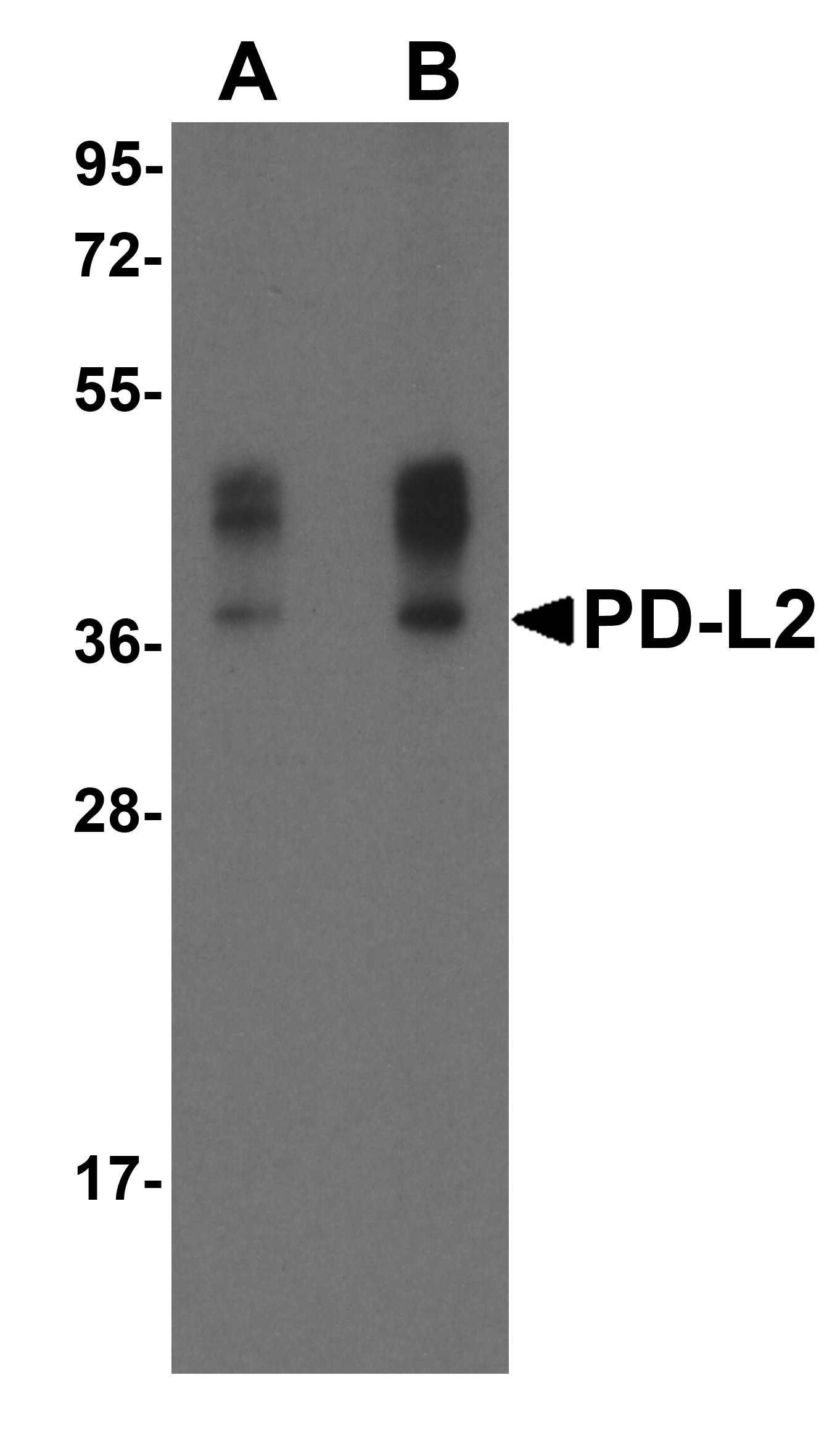 IHC-plus™ PD-L2 / PDCD1LG2 / CD273 Antibody (clone 4E10)