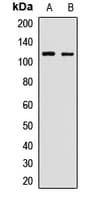 CDH11 / Cadherin 11 Antibody