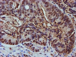PSMB9 Antibody (clone OTI3F3)