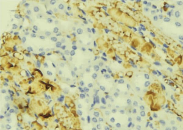 Endostatin Antibody