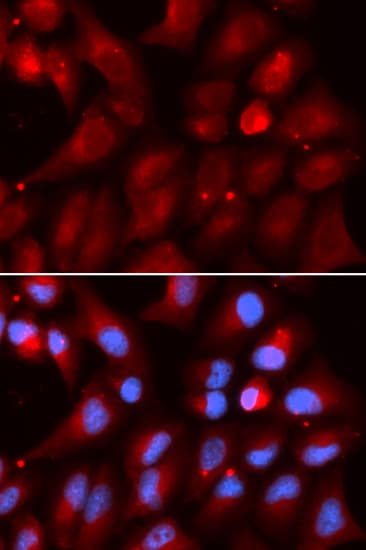 PSMB2 Antibody