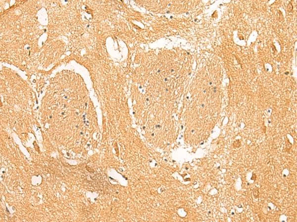 PPP1R1A / IPP1 Antibody
