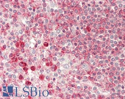 Polyclonal Rabbit anti-Human PTDSS1 Antibody (N-Terminus, IHC, WB)