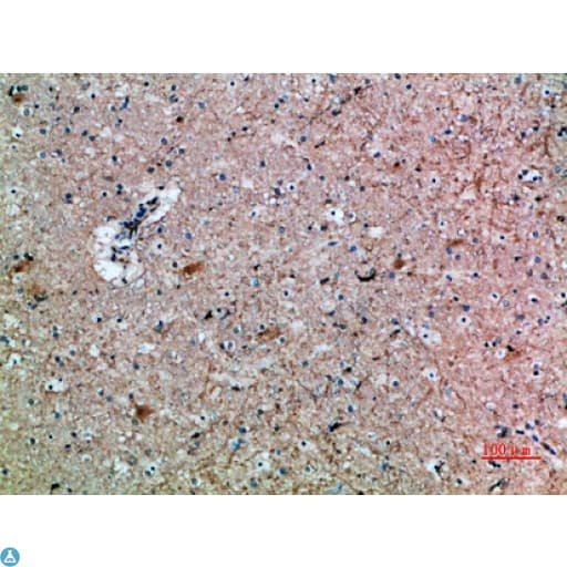 FSHB / FSH Beta Antibody