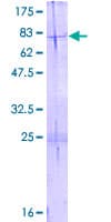 Human HADHB Protein (Recombinant GST)