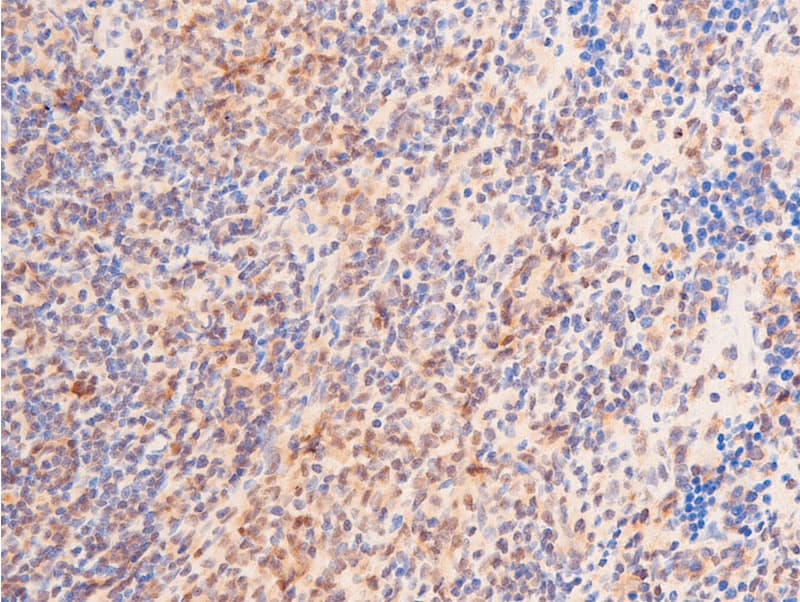 TP53 / p53 Antibody (phospho-Ser392)