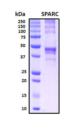 Human Osteonectin / SPARC Protein (Recombinant His, N-Terminal)