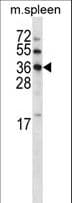 Polyclonal Rabbit anti-Human MOSC2 Antibody (aa304-333, WB)