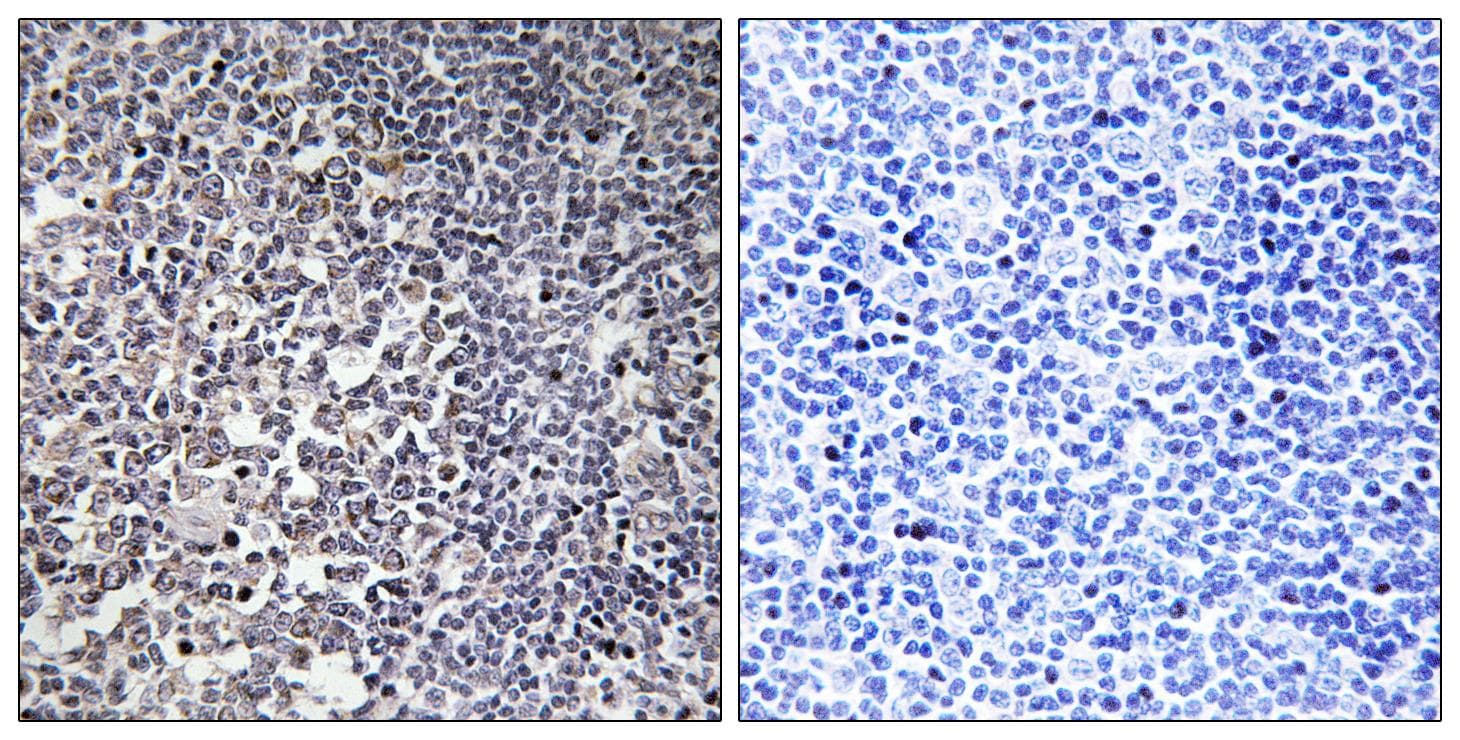 Polyclonal Rabbit anti-Human MRPS16 Antibody (IHC, WB)