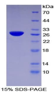 Human TFPI2 Protein (Recombinant His)
