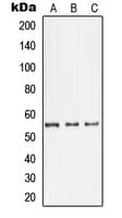 GDI1 Antibody (C-Terminus)