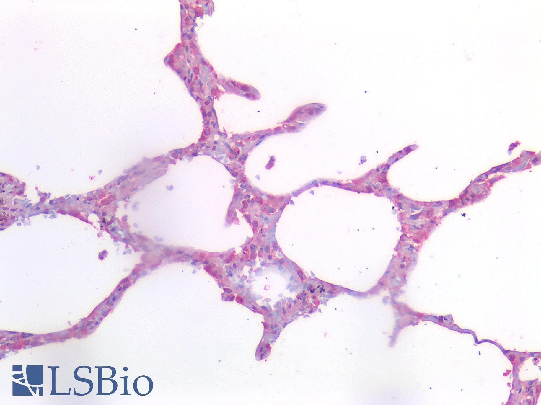 IHC-plus™ PDGFRA / PDGFR Alpha Antibody