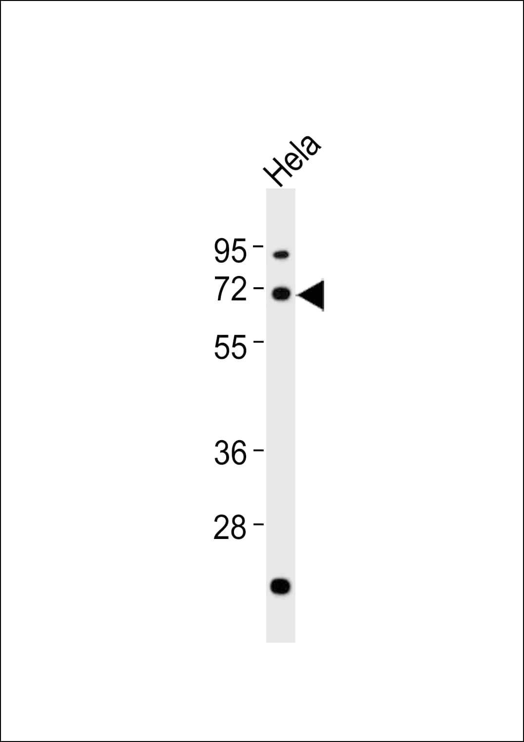 AATF Antibody