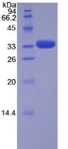 Human TRAF5 Protein (Recombinant His-T7)