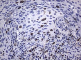Monoclonal Rat anti-Human MKI67 / Ki67 Antibody (clone OTI9C3, IHC, WB)