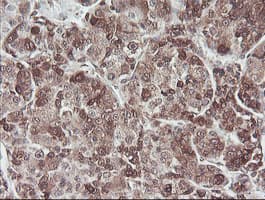 COPS5 / JAB1 Antibody (clone OTI2B12)
