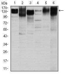 Monoclonal Mouse anti-Human ITGB1 / Integrin Beta 1 / CD29 Antibody (clone 3B6, IHC, WB)