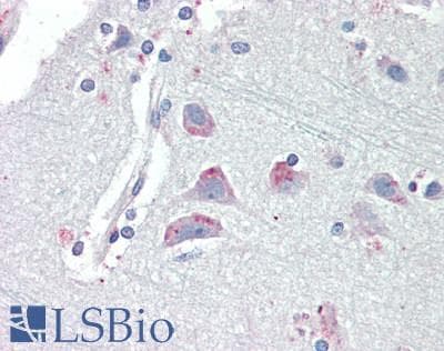 IHC-plus™ Polyclonal Goat anti-Human CRFR1 / CRHR1 Antibody (aa250-263, IHC, IF, WB)