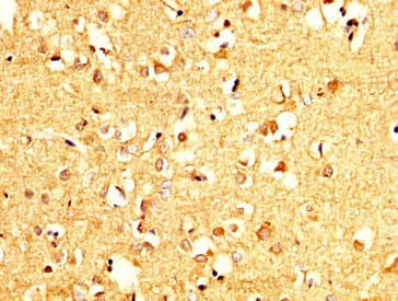 Polyclonal Rabbit anti-Human PCMT1 Antibody (IHC)