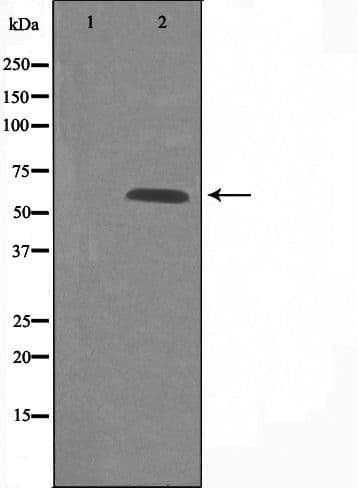 Polyclonal Rabbit anti-Human GPCR6 / GPR101 Antibody (IF, WB)