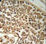 Polyclonal Rabbit anti-Human SERPINH1 / HSP47 Antibody (aa390-418, IHC, WB)