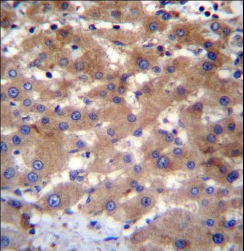 UBE2NL Antibody (aa6-34)