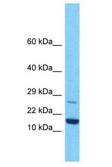 KLLN / KILLIN Antibody (aa129-178)