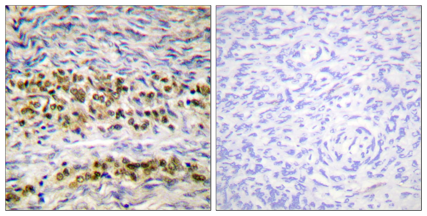 NFKB1 / NF-Kappa-B Antibody (aa891-940)