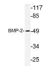BMP2 Antibody (aa250-350)
