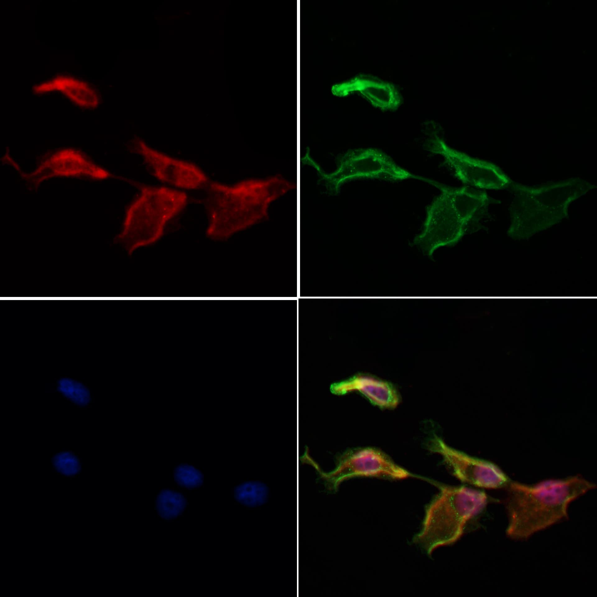 NRDE2 / C14orf102 Antibody