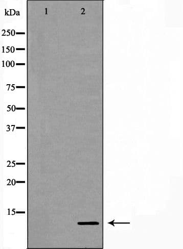 Calgizzarin / S100A11 Antibody