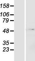 ZNF643 Protein (Over-Expression Lysate Myc-DDK (Flag))