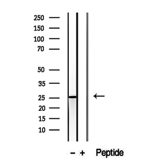 Polyclonal Rabbit anti-Human CHCHD6 Antibody (IHC, WB)