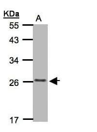 CKLFSF5 / CMTM5 Antibody (aa159-223)