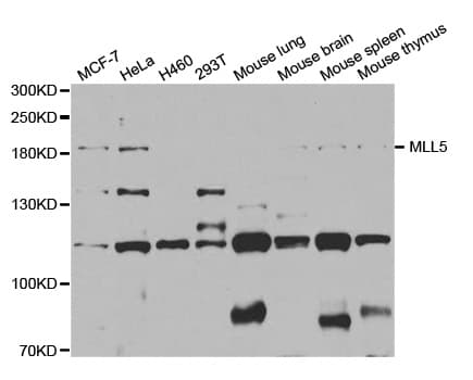 Polyclonal Rabbit anti-Human KMT2E / MLL5 Antibody (IHC, IF, WB)
