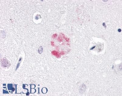 PathPlus™ NR1D1 Antibody (Internal)