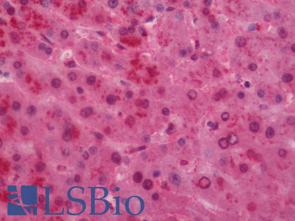 IHC-plus™ Polyclonal Rabbit anti-Human NDUFS1 Antibody (aa620-669, IHC, WB)