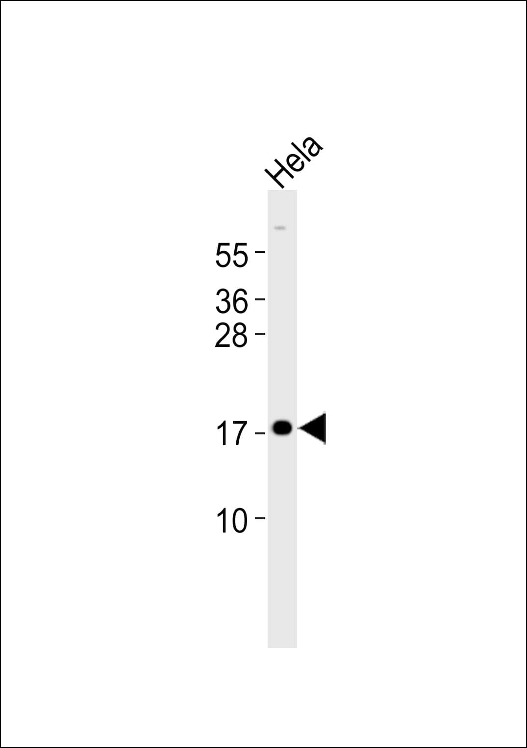 CDKN2C / p18 INK4c Antibody
