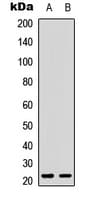 ICOS / CD278 Antibody (Internal)