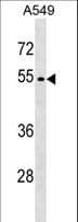 IHC-plus™ GSK3A / GSK3 Alpha Antibody (aa448-478)