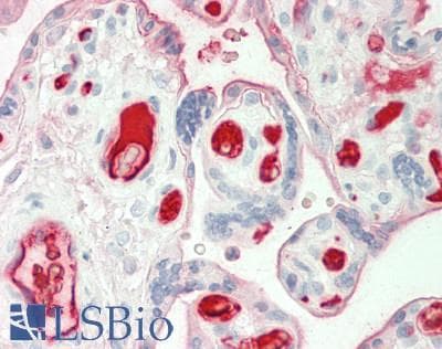 IHC-plus™ Polyclonal Sheep anti-Human A2M / Alpha-2-Macroglobulin Antibody (IHC)