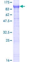Human ZER1 Protein (Recombinant GST)