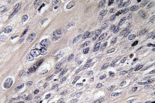 ACO1 / Aconitase Antibody (Asn707)