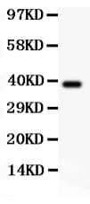 RIPK1 / RIP Antibody (aa316-671)