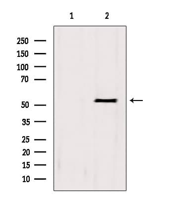 BCS1L Antibody