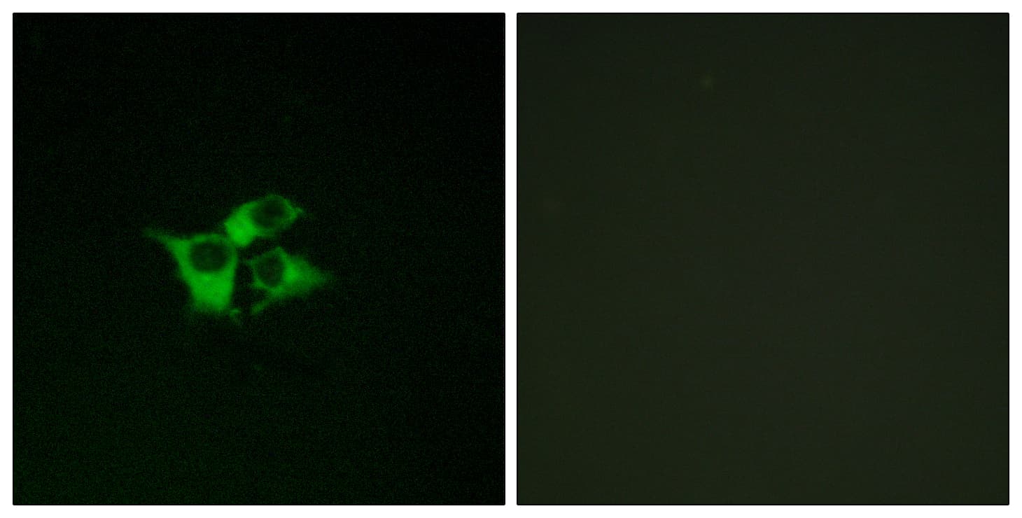 Polyclonal Rabbit anti-Human EDNRA / Endothelin A Receptor Antibody (aa378-427, IF, WB)
