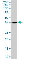 Monoclonal Mouse anti-Human PURA / Pur-Alpha Antibody (clone 3F10, WB)